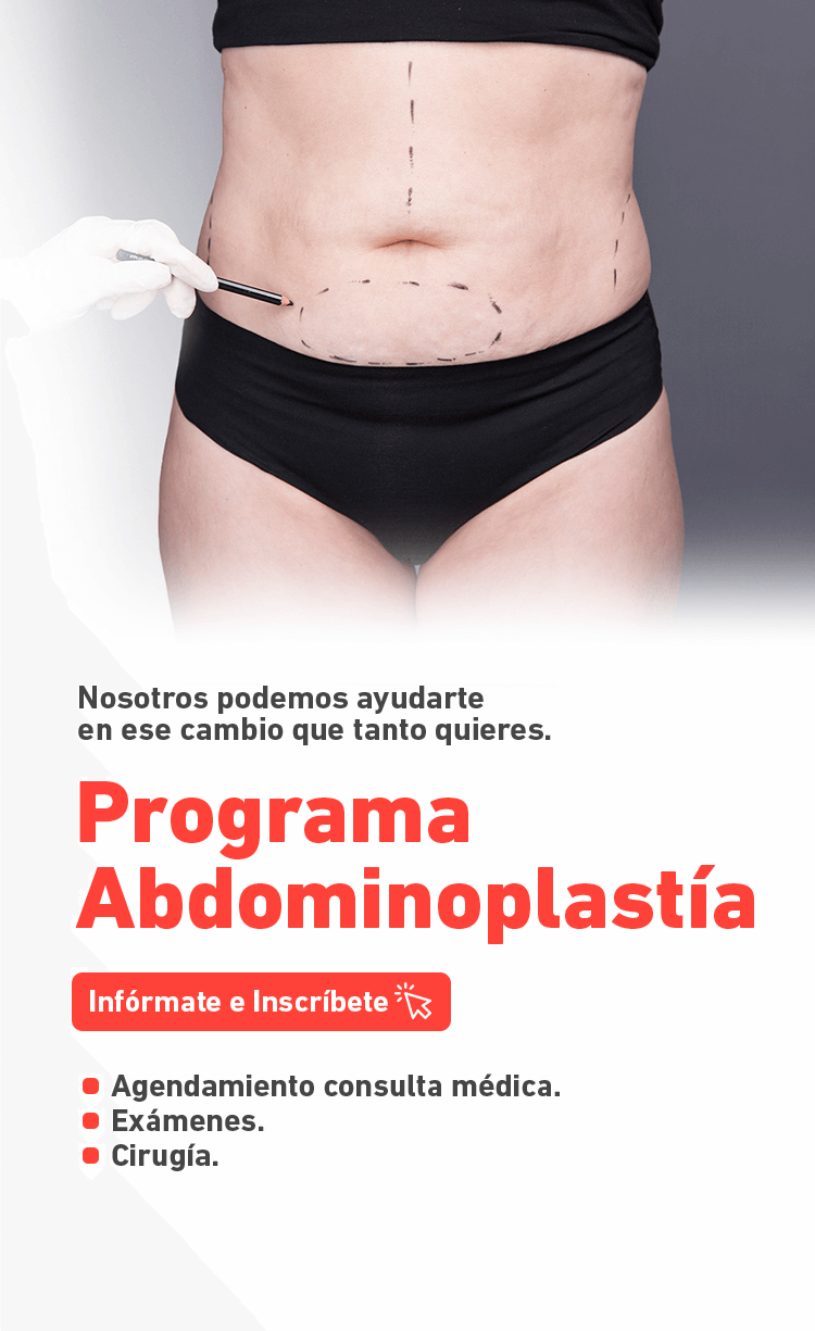 Banner Abdominoplastía