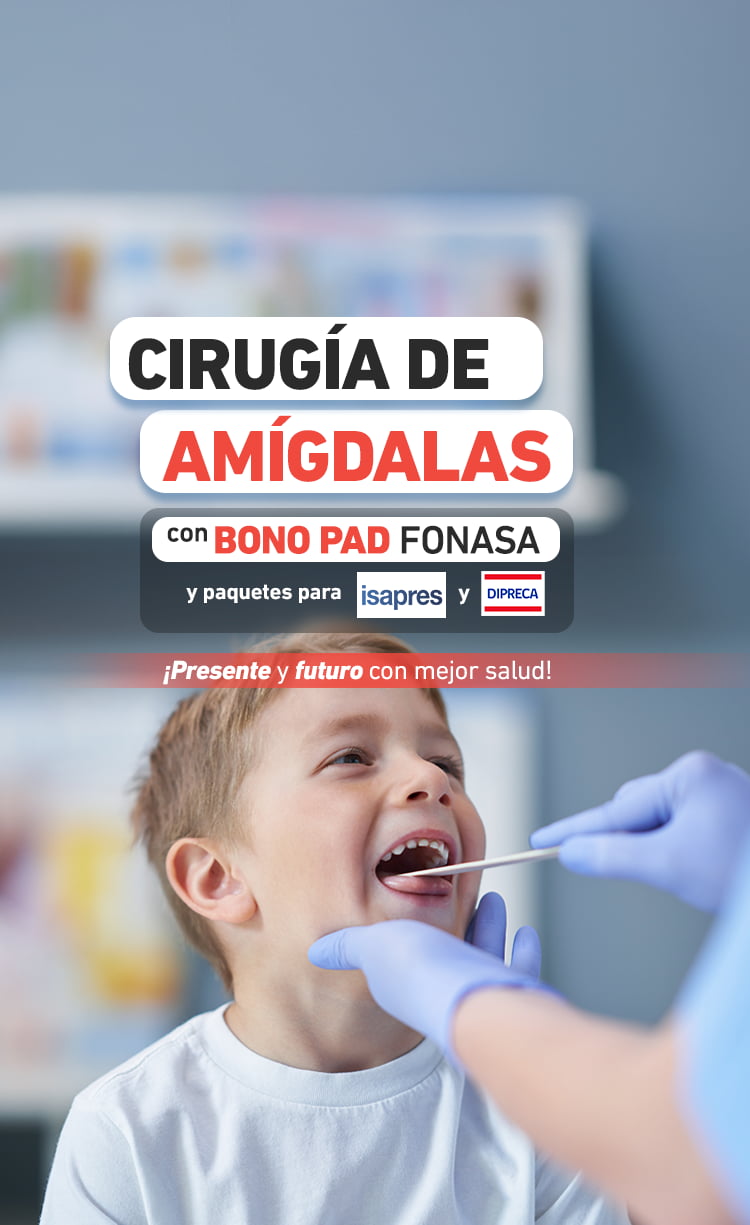 Cirugía de Amígdalas