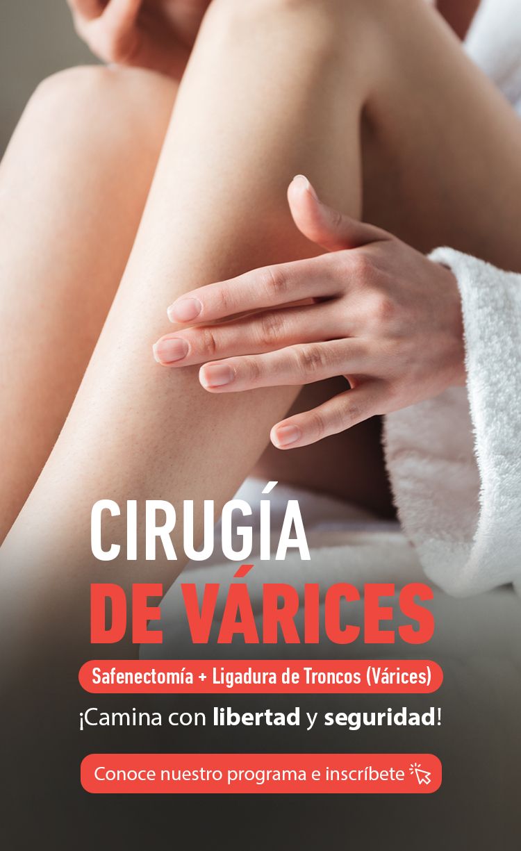Cirugía de Várices